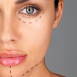 plastic surgery